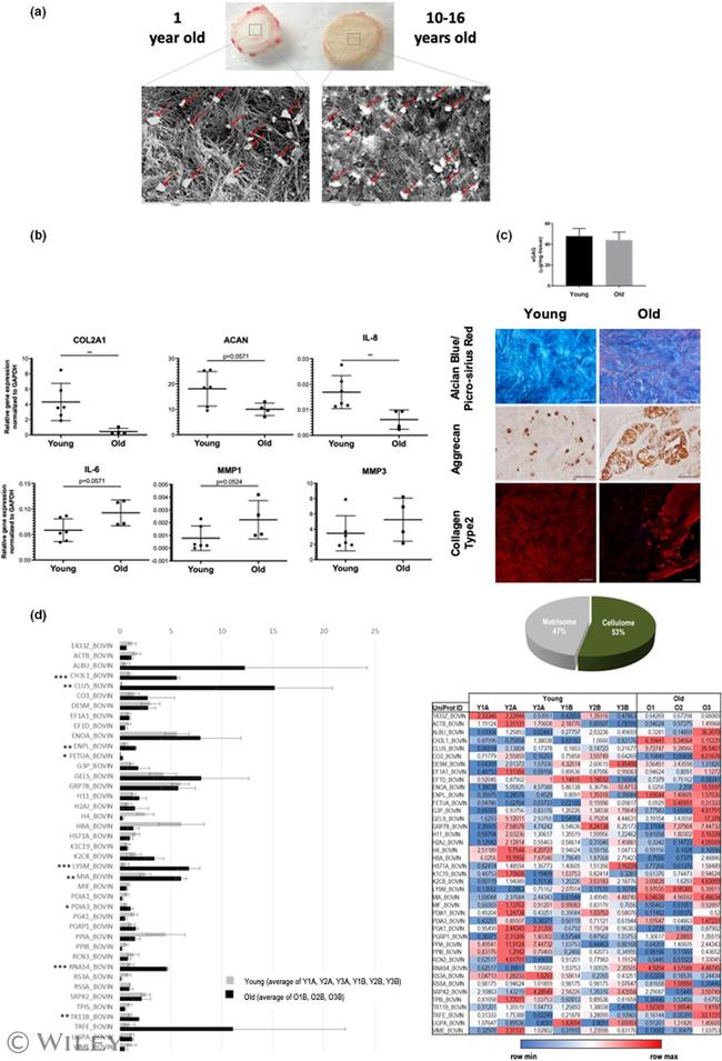 Aggrecan Antibody in Immunohistochemistry (Paraffin) (IHC (P))