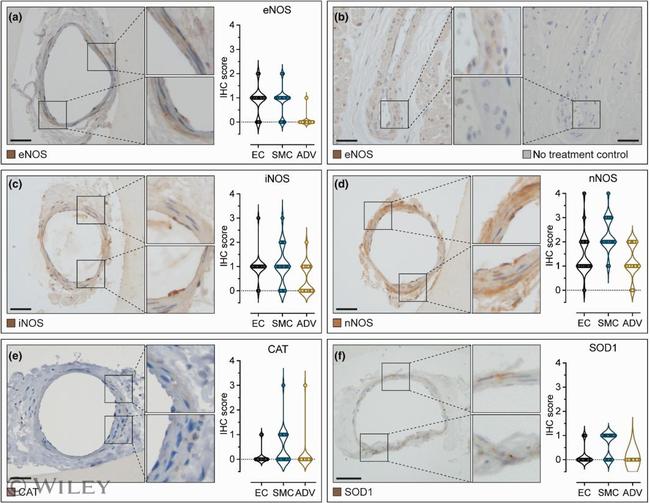 eNOS Antibody in Immunohistochemistry (Paraffin) (IHC (P))