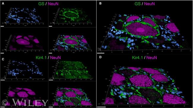 Glutamine Synthetase Antibody in Immunohistochemistry (IHC)