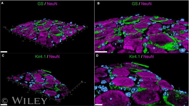 Glutamine Synthetase Antibody in Immunohistochemistry (IHC)