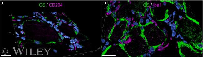 Glutamine Synthetase Antibody in Immunohistochemistry (IHC)