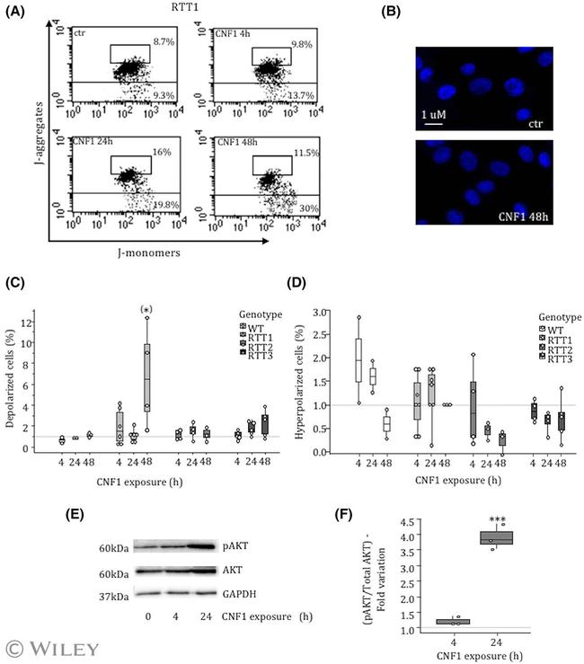 AKT Pan Antibody in Western Blot (WB)