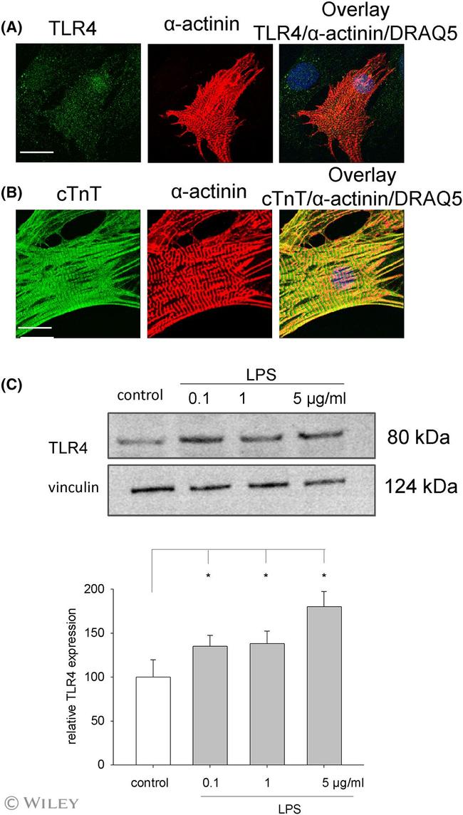 TLR4 Antibody in Immunocytochemistry (ICC/IF)