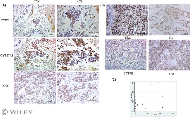 CYP7B1 Antibody in Immunohistochemistry (Paraffin) (IHC (P))