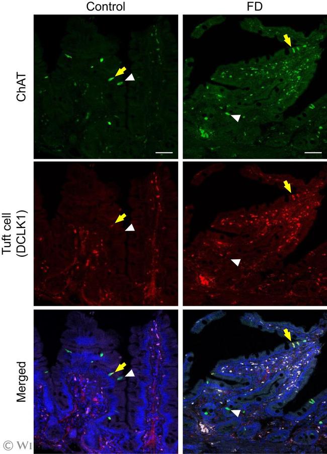 ChAT Antibody in Immunohistochemistry (IHC)