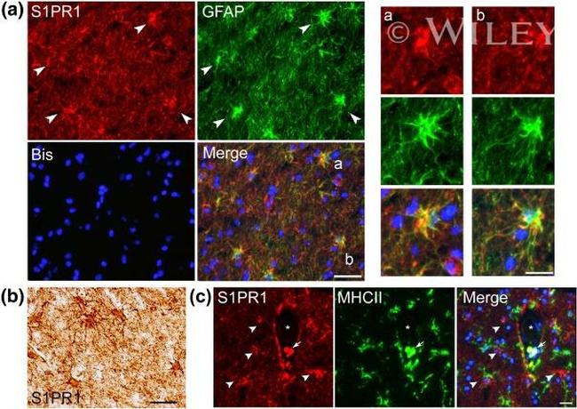 MHC Class II (I-A/I-E) Antibody in Immunohistochemistry (IHC)