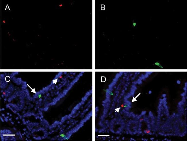 IP3 Receptor 1 Antibody in Immunohistochemistry (Paraffin) (IHC (P))