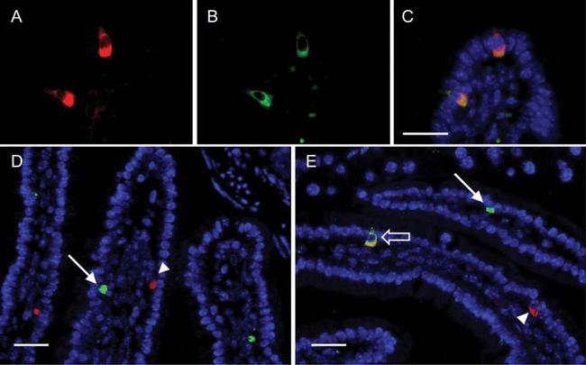 IP3 Receptor 1 Antibody in Immunohistochemistry (Paraffin) (IHC (P))