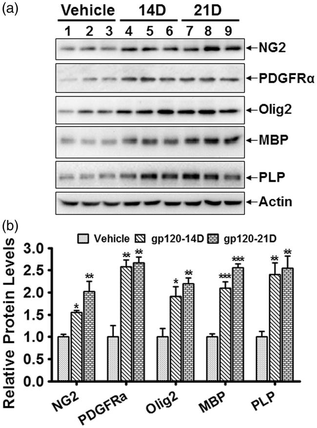 PLP1 Antibody in Western Blot (WB)