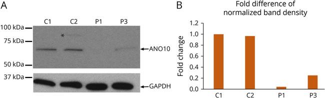 TMEM16K Antibody in Western Blot (WB)