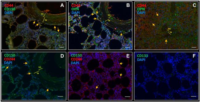 CD244 Antibody in Immunohistochemistry (Paraffin) (IHC (P))