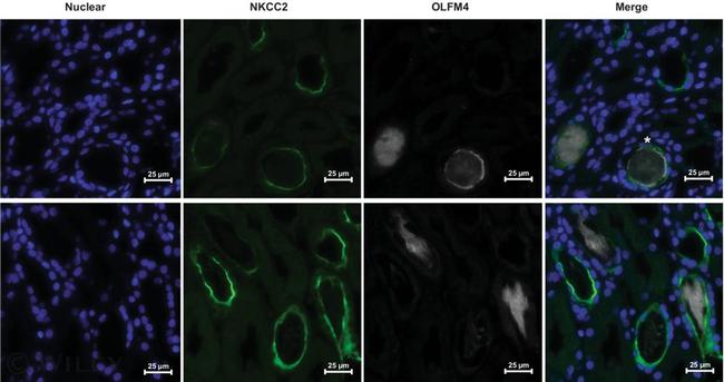 OLFM4 Antibody in Immunocytochemistry (ICC/IF)