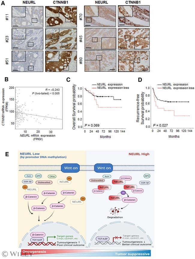 beta Catenin Antibody in Immunohistochemistry (IHC)