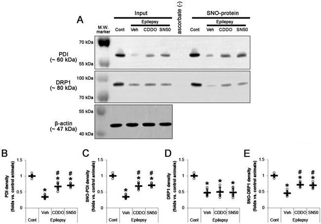 DNM1L Antibody in Western Blot (WB)