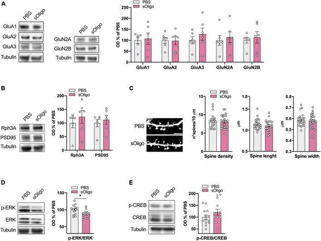 NMDAR2B Antibody in Western Blot (WB)