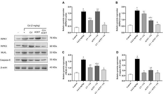 RIP3 Antibody in Western Blot (WB)