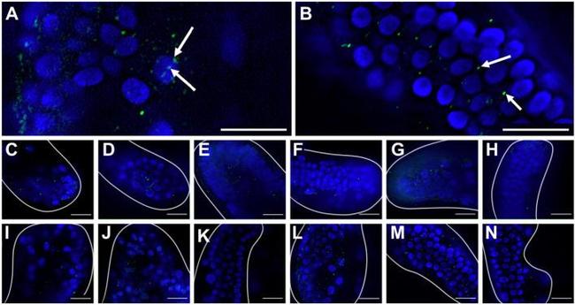 Active/Pro-Caspase 3 Antibody in Immunohistochemistry (Paraffin) (IHC (P))