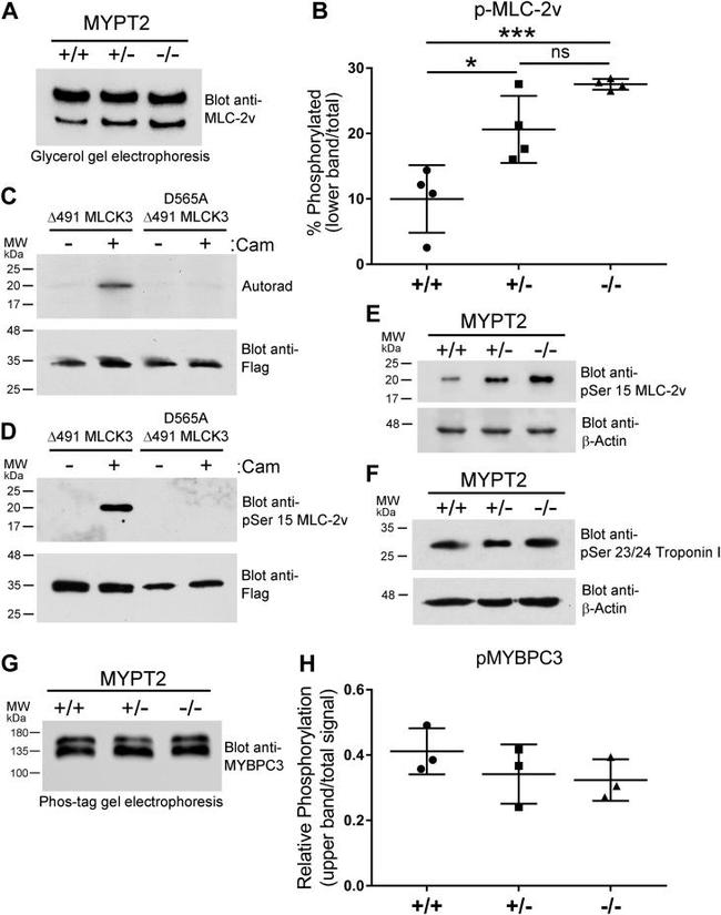 Phospho-MYL2 (Ser15) Antibody in Western Blot (WB)