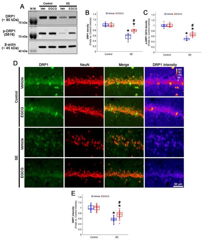 DNM1L Antibody in Western Blot (WB)