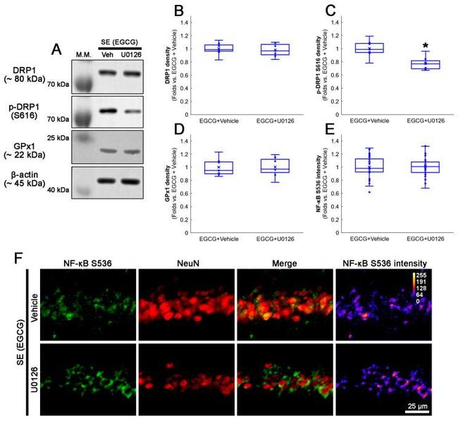 DNM1L Antibody in Western Blot (WB)