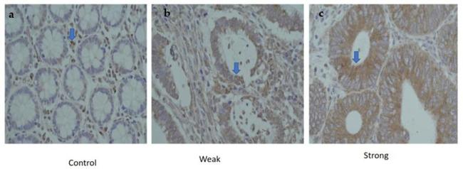 CTLA-4 Antibody in Immunohistochemistry (Paraffin) (IHC (P))