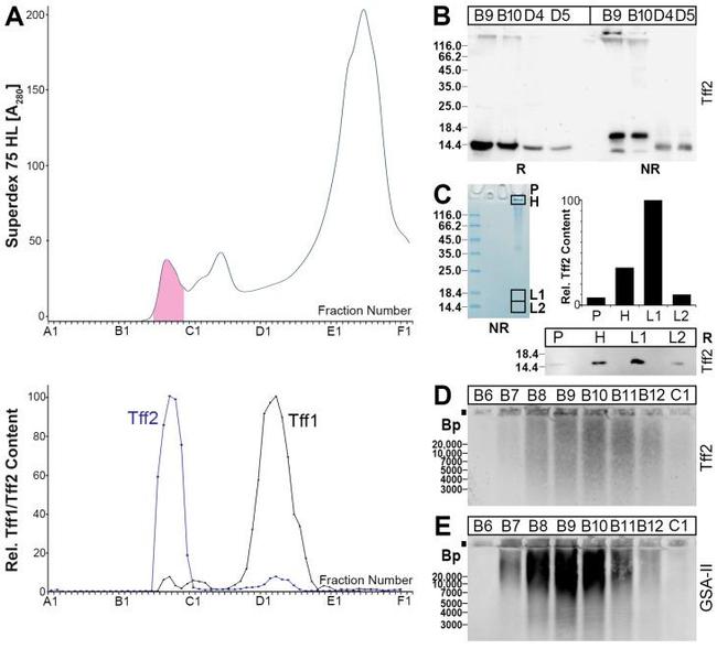 TFF2 Antibody in Western Blot (WB)