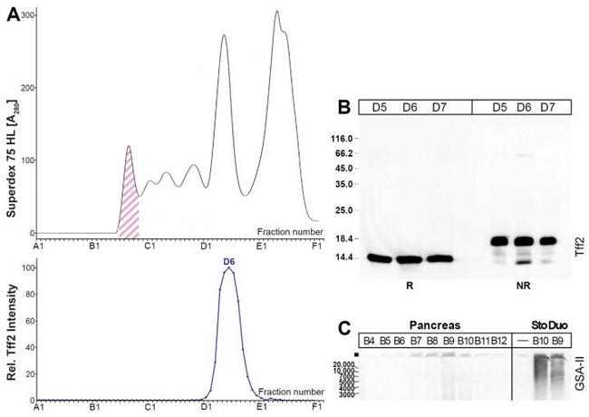 TFF2 Antibody in Western Blot (WB)