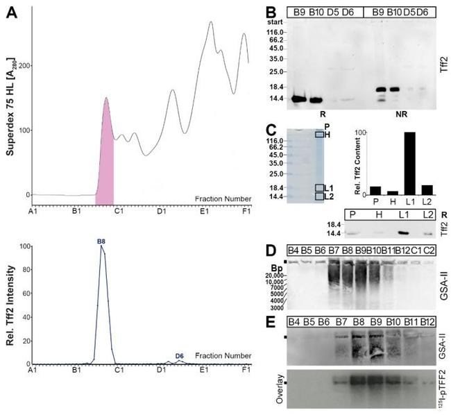 TFF2 Antibody in Western Blot (WB)