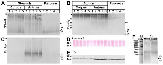 TFF2 Antibody in Western Blot (WB)