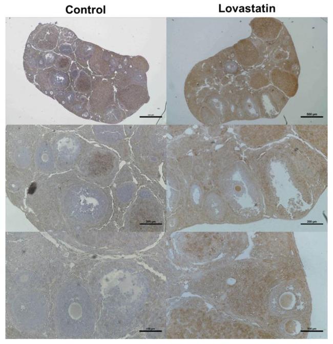 LDLR Antibody in Immunohistochemistry (Paraffin) (IHC (P))