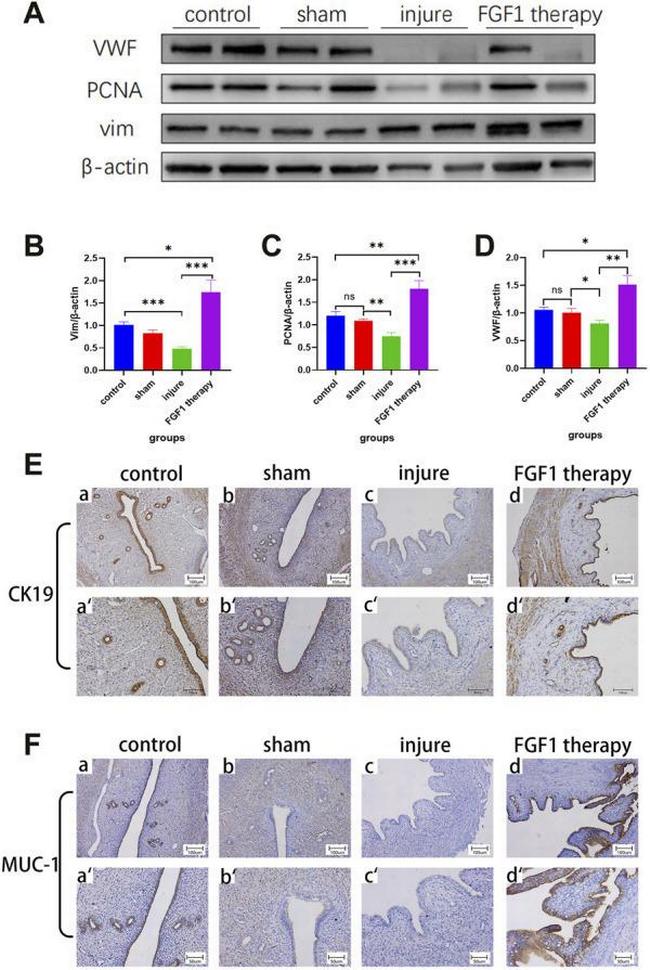 MUC1 Antibody in Immunohistochemistry (Paraffin) (IHC (P))