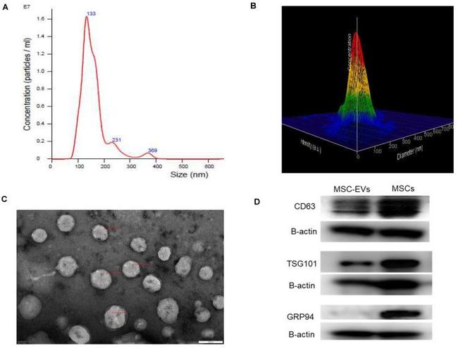 TSG101 Antibody in Western Blot (WB)