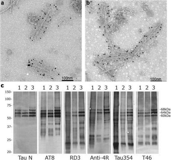 Tau Antibody in Western Blot (WB)