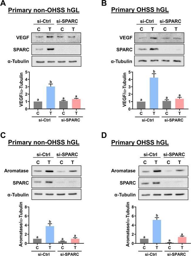 VEGF Antibody in Western Blot (WB)