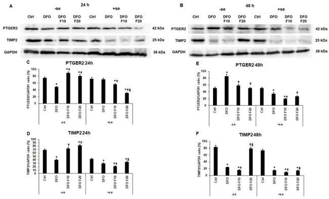 TIMP2 Antibody in Western Blot (WB)