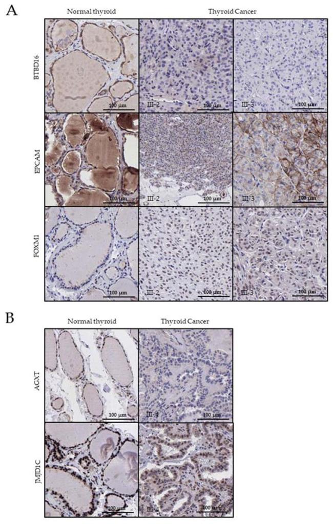 EpCAM Antibody in Immunohistochemistry (Paraffin) (IHC (P))