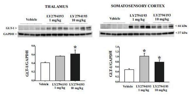 GLT-1 Antibody in Western Blot (WB)