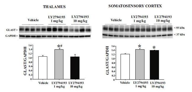 GLT-1 Antibody in Western Blot (WB)