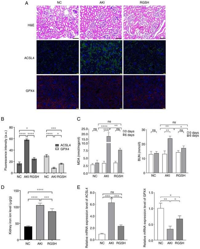 ACSL4 Antibody in Immunohistochemistry (Paraffin) (IHC (P))