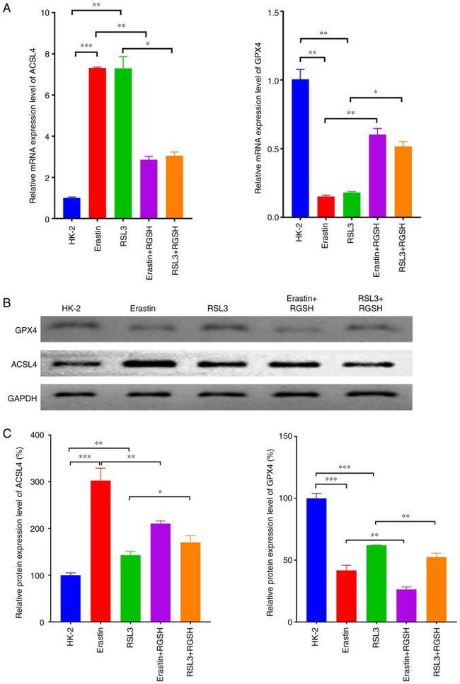 ACSL4 Antibody in Western Blot (WB)