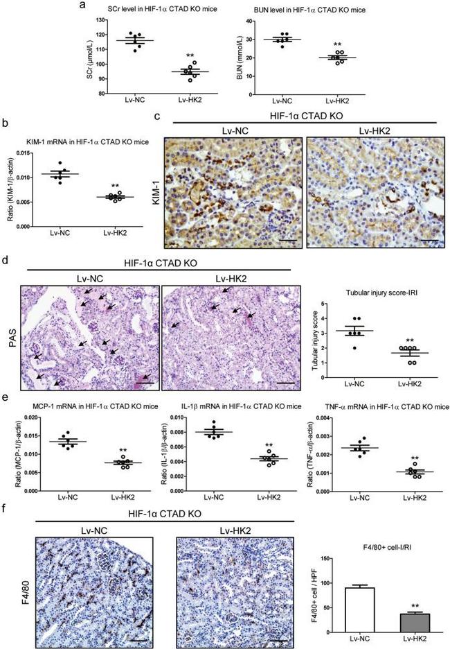 CD365 (TIM1) Antibody in Immunohistochemistry (Paraffin) (IHC (P))