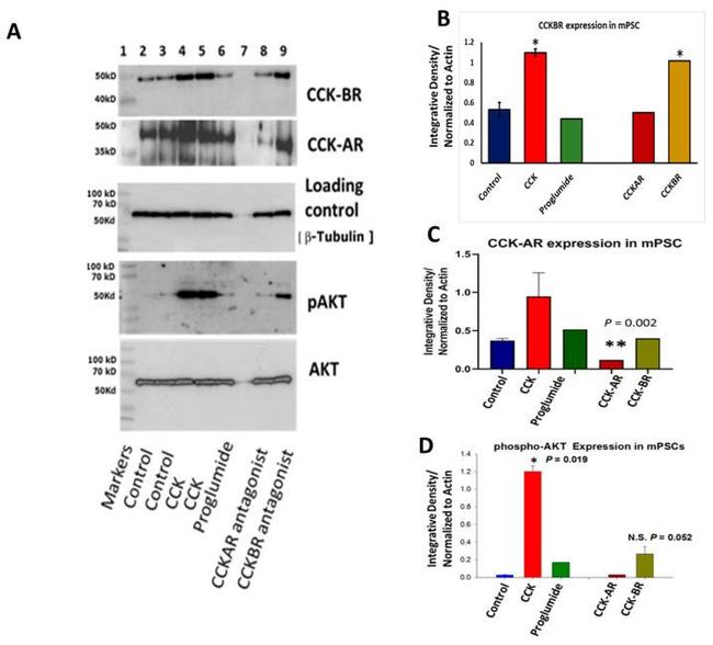 Phospho-AKT1 (Ser473) Antibody in Western Blot (WB)