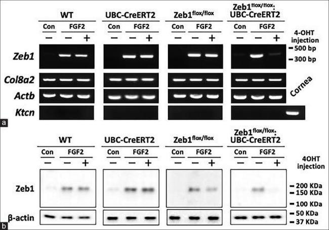 ZEB1 Antibody in Western Blot (WB)