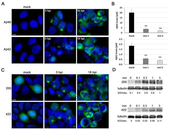 Phospho-Tau (Thr205) Antibody in Western Blot (WB)