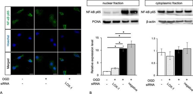 NFkB p65 Antibody in Western Blot (WB)