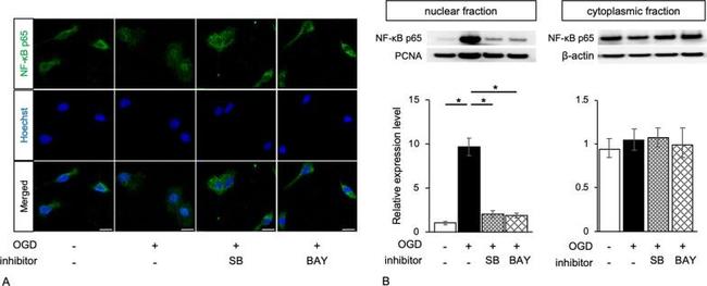 NFkB p65 Antibody in Western Blot (WB)