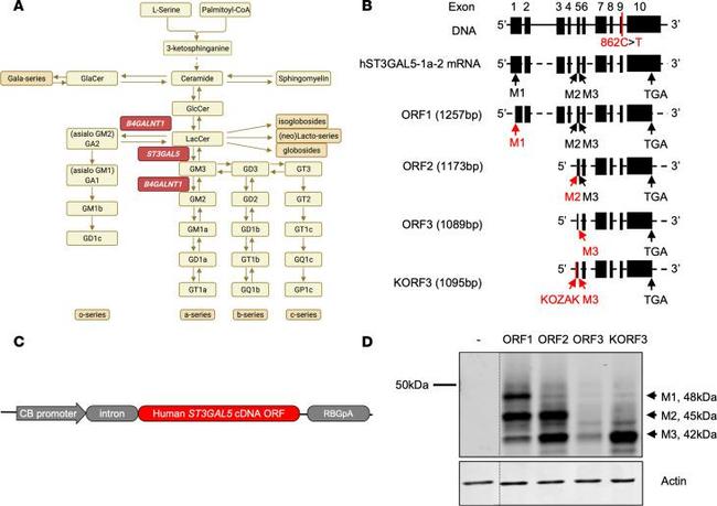 ST3GAL5 Antibody in Western Blot (WB)