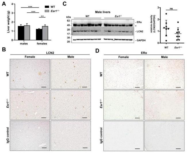 Estrogen Receptor alpha Antibody in Immunohistochemistry (Paraffin) (IHC (P))