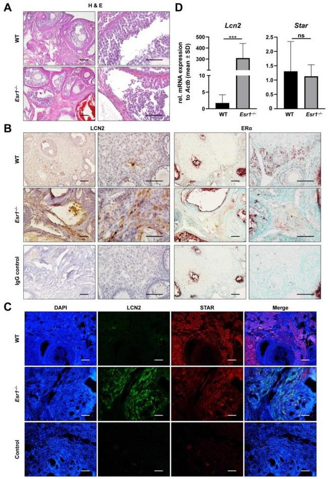 Estrogen Receptor alpha Antibody in Immunohistochemistry (Paraffin) (IHC (P))