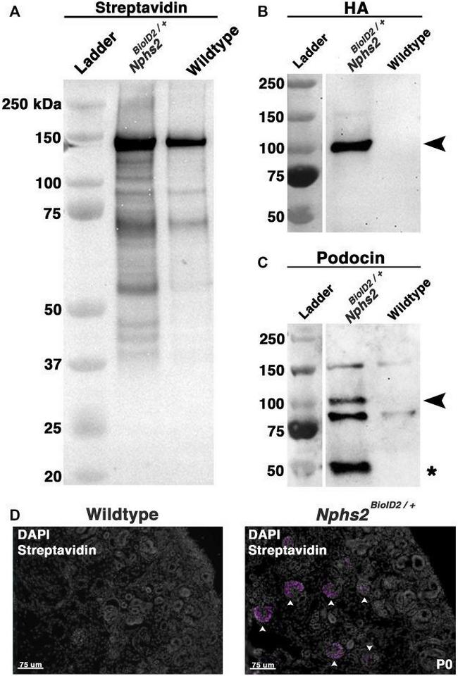 Podocin Antibody in Western Blot (WB)